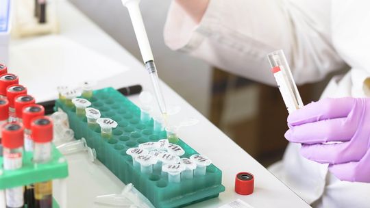 Nie zwlekaj! Zadbaj o zdrowie i wykonaj bezpłatną cytologię