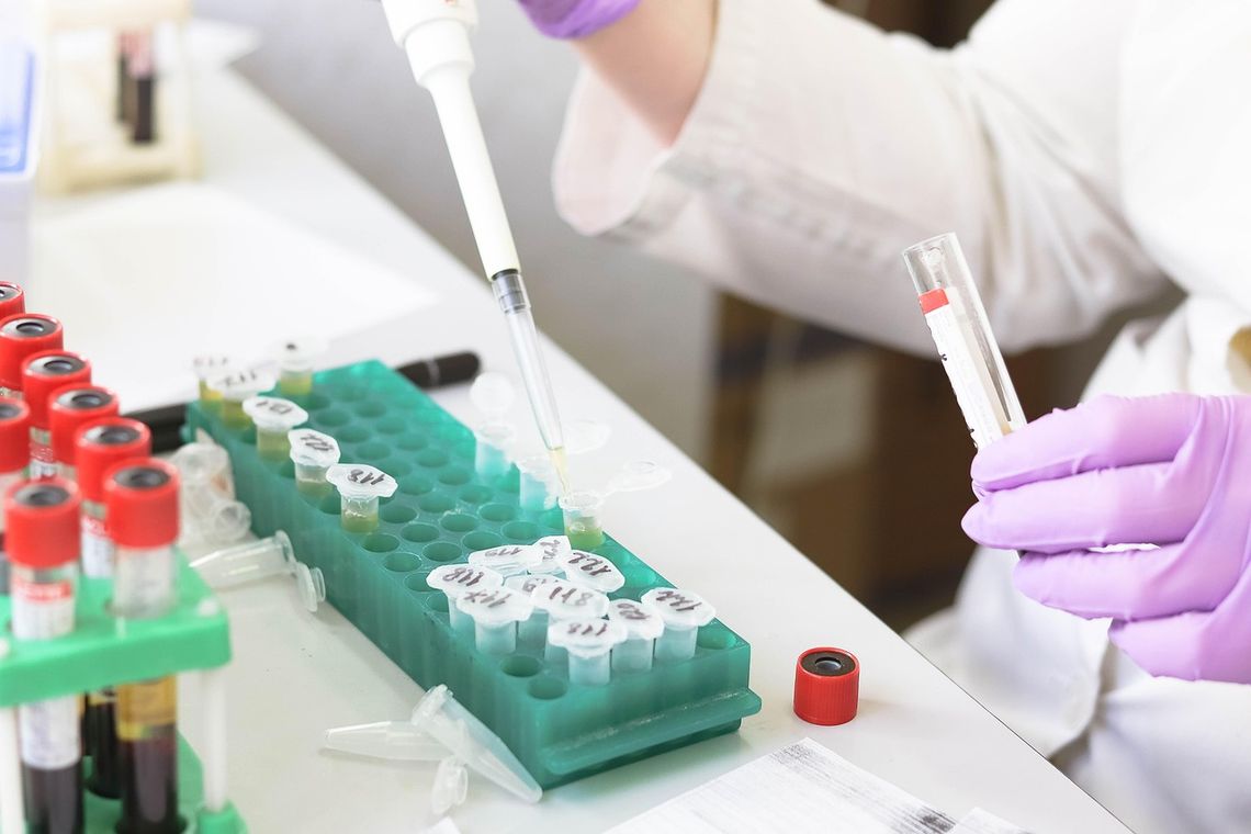 Nie zwlekaj! Zadbaj o zdrowie i wykonaj bezpłatną cytologię